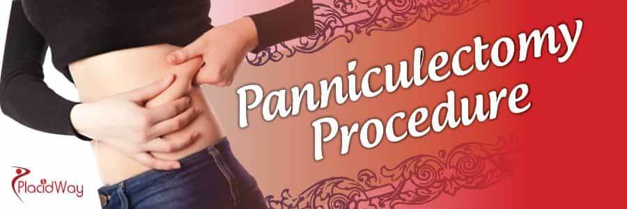 Panniculectomy Procedure, Weight Loss Surgery